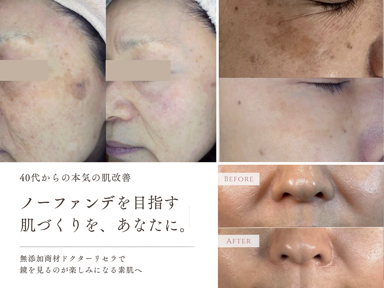 サロンドアモール(Salon de a mole)｜ホットペッパービューティー