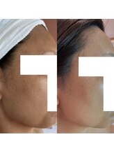 由縁/美肌フェイシャル