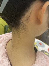 サロン オブ ロータス(Salon of Lotus)/えりあし　シェービング前