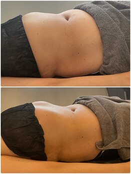 ウル(Ulu)/腸もみビフォーアフター