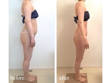 ベレミアム(Bellemium)/骨格調整×痩身リンパ