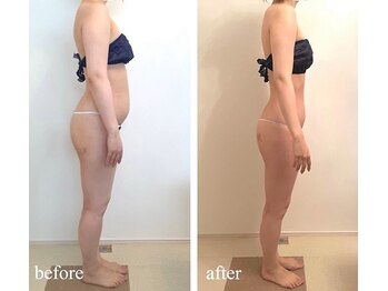 ベレミアム(Bellemium)/骨格調整×痩身リンパ