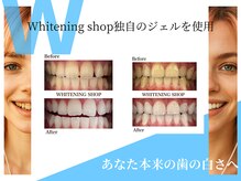 ホワイトニングショップ 春日井店(whitening shop)