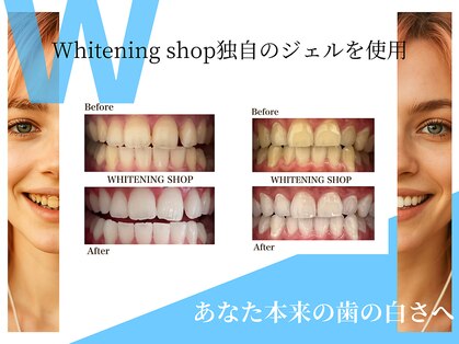 ホワイトニングショップ 春日井店(whitening shop)の写真