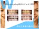 ホワイトニングショップ 春日井店(whitening shop)の写真