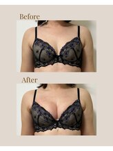 リネア(Linea)/【Before→After】30代後半