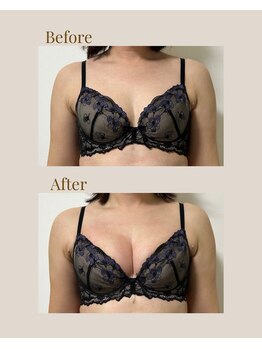 リネア(Linea)/【Before→After】30代後半