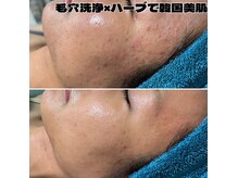 アンドワイ バイ サロンリーナ(&y by Salon Lena)の雰囲気（日本初！生ハーブ！顔も背中も肌美人☆フォトギャラリーcheck☆）