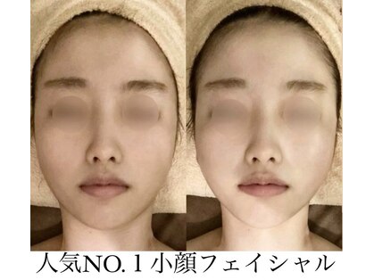 サロンハート(Salon Heart)の写真