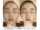 サロンハート(Salon Heart)の写真