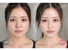小顔矯正プロの雰囲気（一度の施術で【即実感】スッキリ爽快♪仕事のパフォーマンスUP☆）