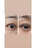 【6月先着３名】大人気/目周りの悩み/眼精疲労/シワ改善/ナノカレ顔&目ケア