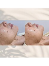 エミナル バイ ニコドット(Eminal by nico.)/フェイシャル小顔・筋膜リリース