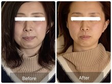 カピリナ(ka pilina)/脳洗浄ドライヘッドスパ