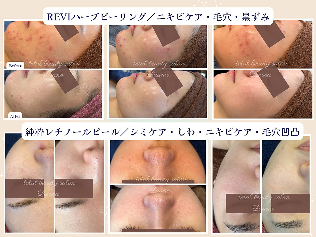 ルアナ 柏本店(LUANA)｜ホットペッパービューティー