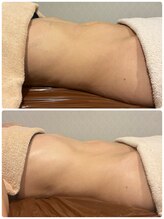 ビューティーサロン ラグジューム(Beauty salon Laxum)/赤岩式腸けずり