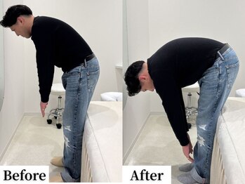 ソレア(Solea)/腰痛改善1回目