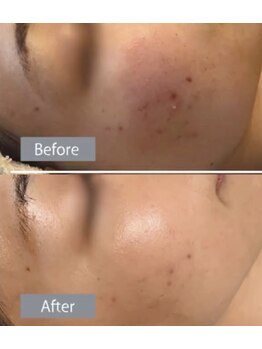 ゴールドプラス 小牧店(GOLD PLUS)/BeforeAfter