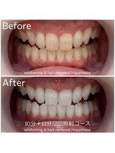ハピネス 広島並木通り店(Happiness)/【U24】限定クーポン