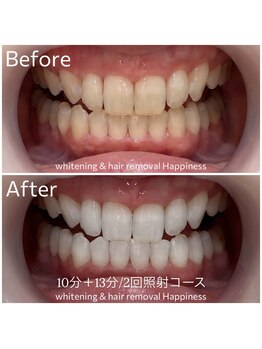 ハピネス 広島並木通り店(Happiness)/【U24】限定クーポン