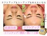 《満足度No.1♪４０代～》お悩みにコレ！イチ押し☆最強エイジングケア120分