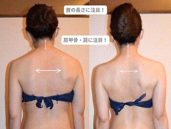 ピュアノア 垂水店/ブライダルエステ　神戸垂水明石