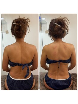 ピンクマジック(PINKMAGIC)/リリースカッター施術ビフォアフ