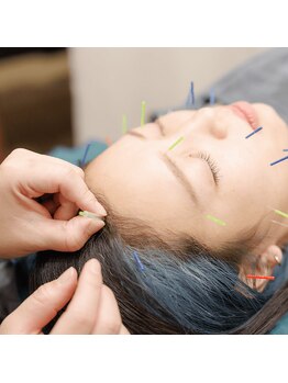 鍼灸整骨院 イーアス(E'as)/美容鍼