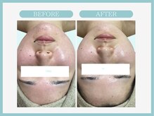 アコガレコガオ 青森店/