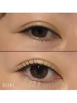 ミル(Mil)/アップフォースリフト