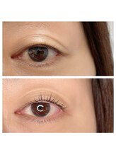 メメシー 相模原(memeshe)/ビフォー/ アフター