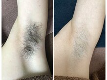 プリマプリート メンズ店/人気部位の１つです！