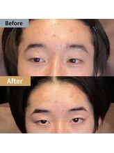 眉毛ハウス 吉祥寺店(眉毛HOUSE)/お客様の施術例(吉祥寺/東京)