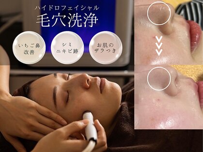 ヒヨリ(hiyori)の写真