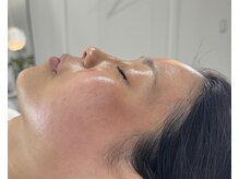 ルミライズ(Lumirise)の雰囲気（大人気★艶肌WAXで産毛/顔ダニ/角質除去！お顔脱毛）