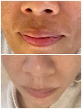 サラシック(salachic)/