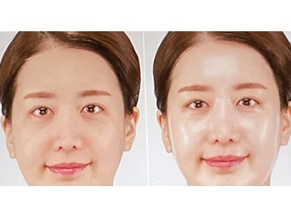 サナティオ(SANATIO)の写真