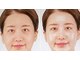 サナティオ(SANATIO)の写真