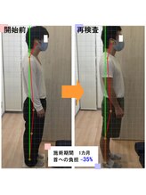 まつむらカイロプラクティック 新宿/【姿勢習慣化プログラム 】実例3