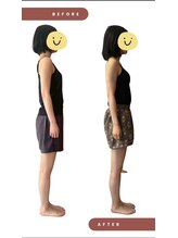 ブルーミングデイズ(blooming days)/全身整体ビフォーアフター