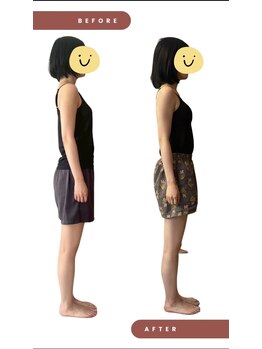 ブルーミングデイズ(blooming days)/全身整体ビフォーアフター