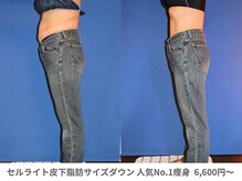 ピュアノア 三木店/痩身　三木/小野/西脇/加東/加西