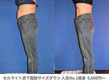 ピュアノア 三木店/痩身　三木/小野/西脇/加東/加西