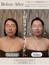 アイミーボーテ(Aime beaute)/コルギ