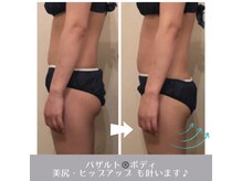 ラ ルミエール(La Lumiere)/バザルトはお尻も上げちゃいます