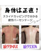 エフプラネット(F Planet)/スライドカッピング