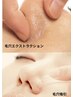 初回【ブツブツいちご鼻改善】毛穴改善フェイシャル　60分￥9,000→￥7,000