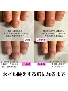 クウ(KUU)/深爪→美爪