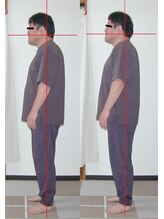 ピュアリー整療院/施術前後（横）