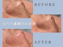 ビーラボ(Be-Lab.)の雰囲気（角栓パックで蓄積汚れを浮かせて落とし黒ずみ・詰まり毛穴を改善）